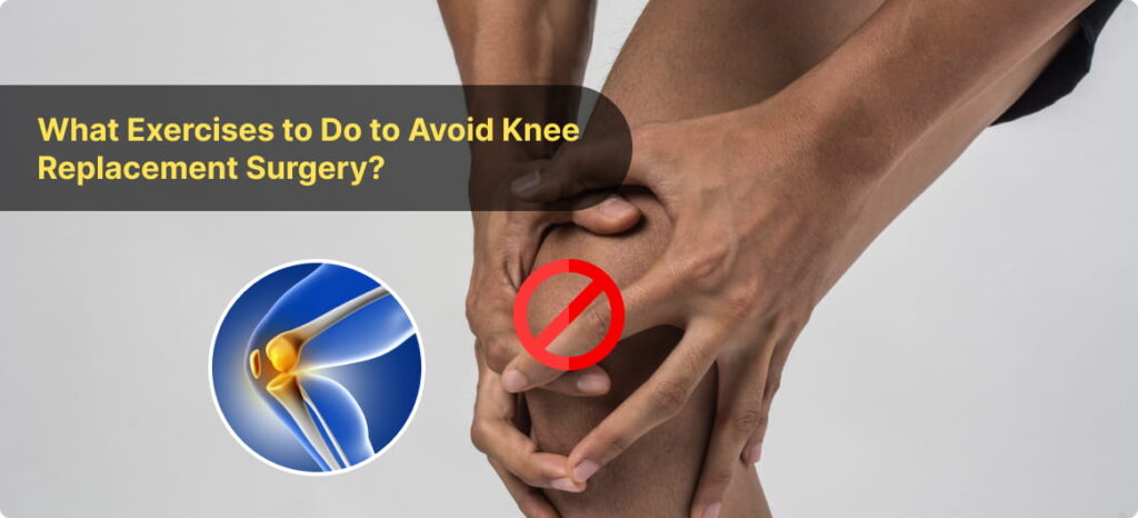 What Exercises to Do to Avoid Knee Replacement Surgery?
