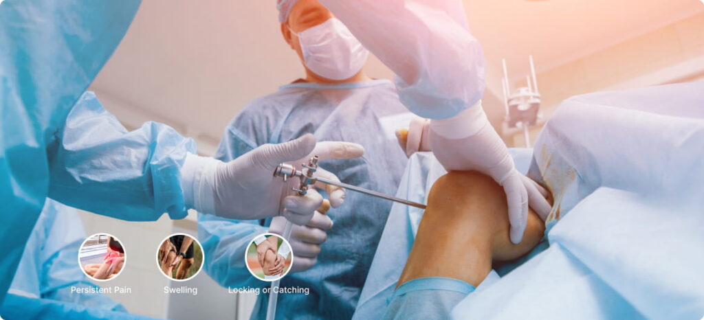 When Is Arthroscopy Surgery Recommended? Signs, Symptoms, and Real-World Situations